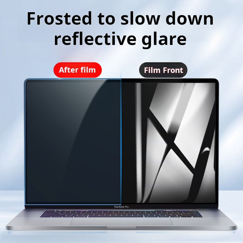 Macbook screen film is suitable for Apple Notebook MacBook Air Anti-Blue Light Pro Eye Protection M2M3 Protective Film
